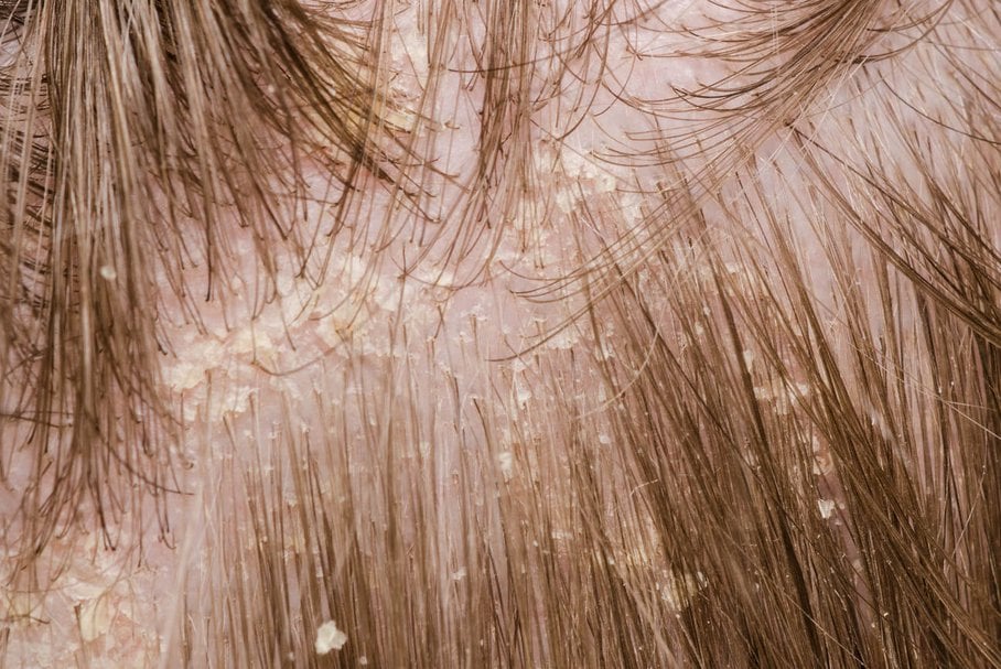 alkemilla wzmacniający szampon do włosów słabych i zniszczonych